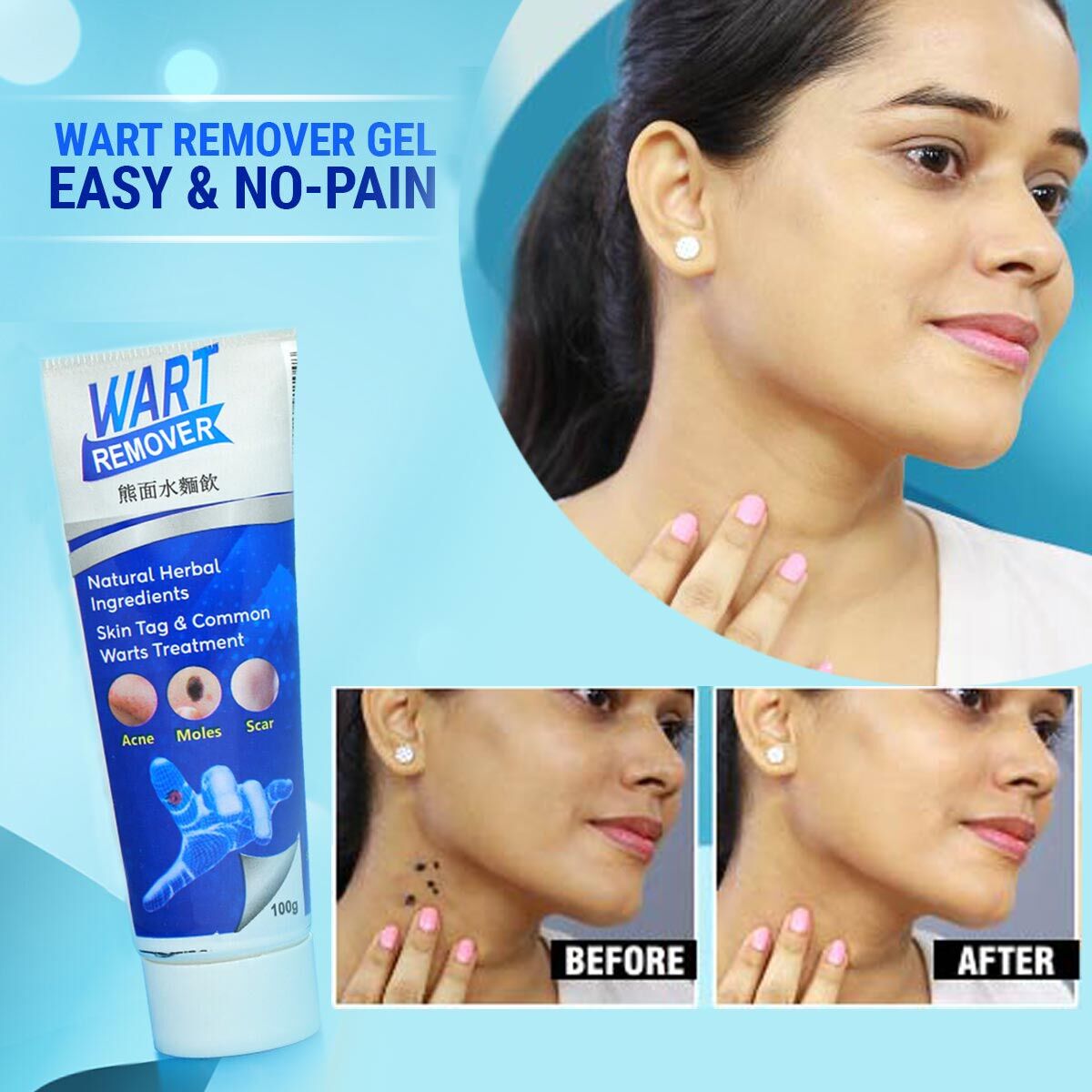 💥BUY 1 GET 1 FREE💥 INSTANT WARTS REMOVER CREAM🤩